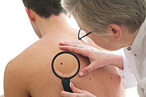 Removing Skin Tags Yourself
