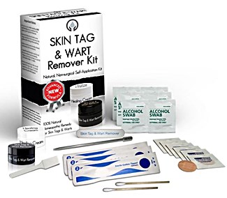 Skin Tag & Wart Remover Kit review