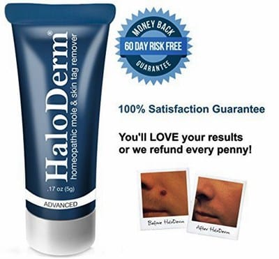 HaloDerm product for removing skin tags safely