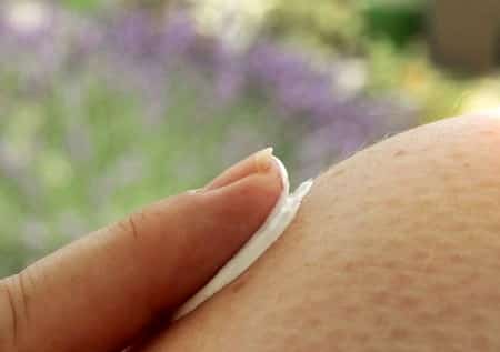 Woman applying skin tag removal cream to a skin tag on her leg