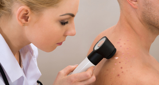 Skin Tags vs Moles Top 10 Differences